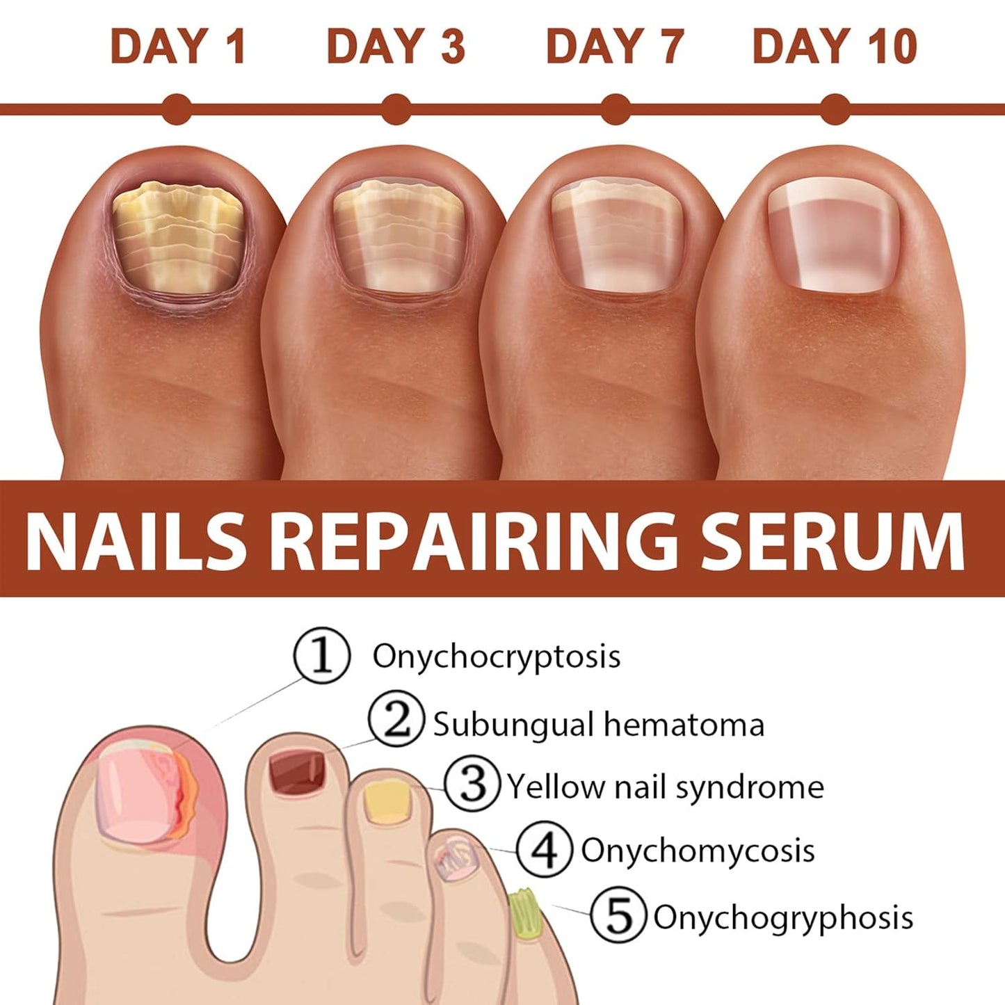 Rednow Gfouk 7 Days Nail – Suero Reparador y Fortalecedor de Uñas (2 Unidades) 🌸 Crecimiento y Cuidado en 7 Días