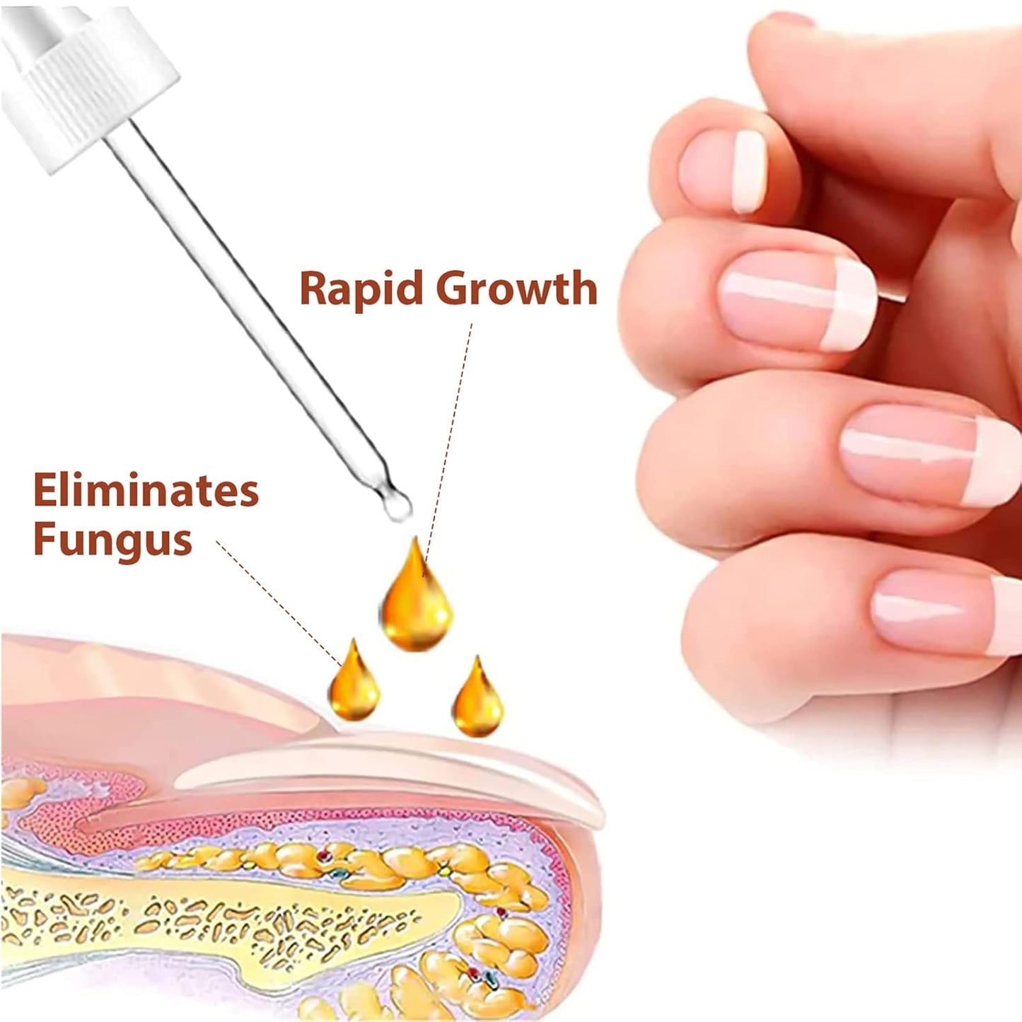 Rednow Gfouk 7 Days Nail – Suero Reparador y Fortalecedor de Uñas (2 Unidades) 🌸 Crecimiento y Cuidado en 7 Días