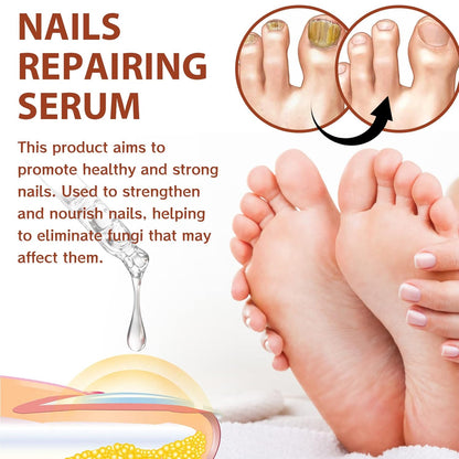 Rednow Gfouk 7 Days Nail – Suero Reparador y Fortalecedor de Uñas (2 Unidades) 🌸 Crecimiento y Cuidado en 7 Días