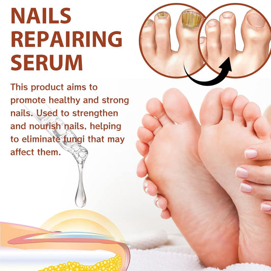 Rednow Gfouk 7 Days Nail – Suero Reparador y Fortalecedor de Uñas (2 Unidades) 🌸 Crecimiento y Cuidado en 7 Días